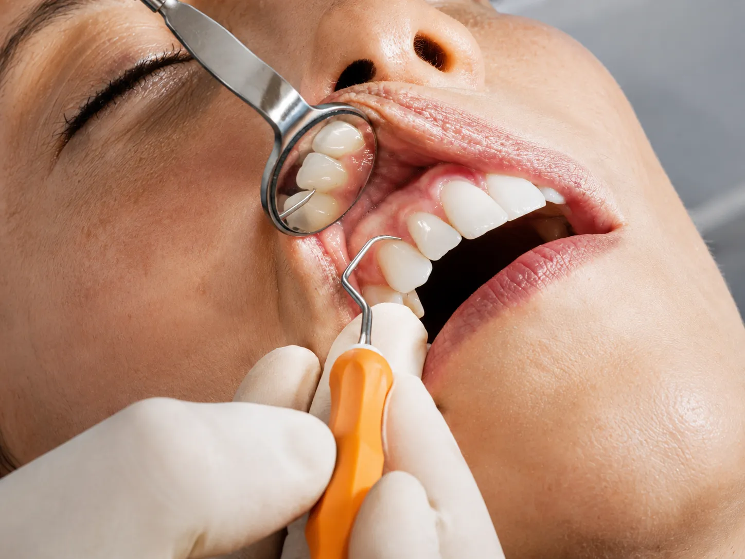 Odontología preventiva en Neodentis