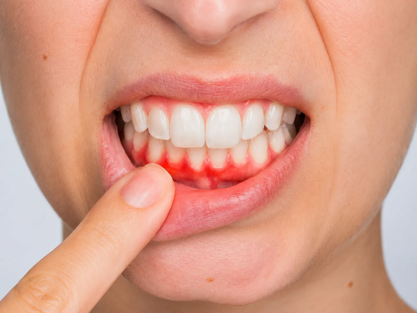 Periodoncia en Neodentis